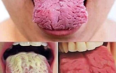 These Are the Consequences of Sleeping With the Signs Your Tongue Is Trying to Warn You About