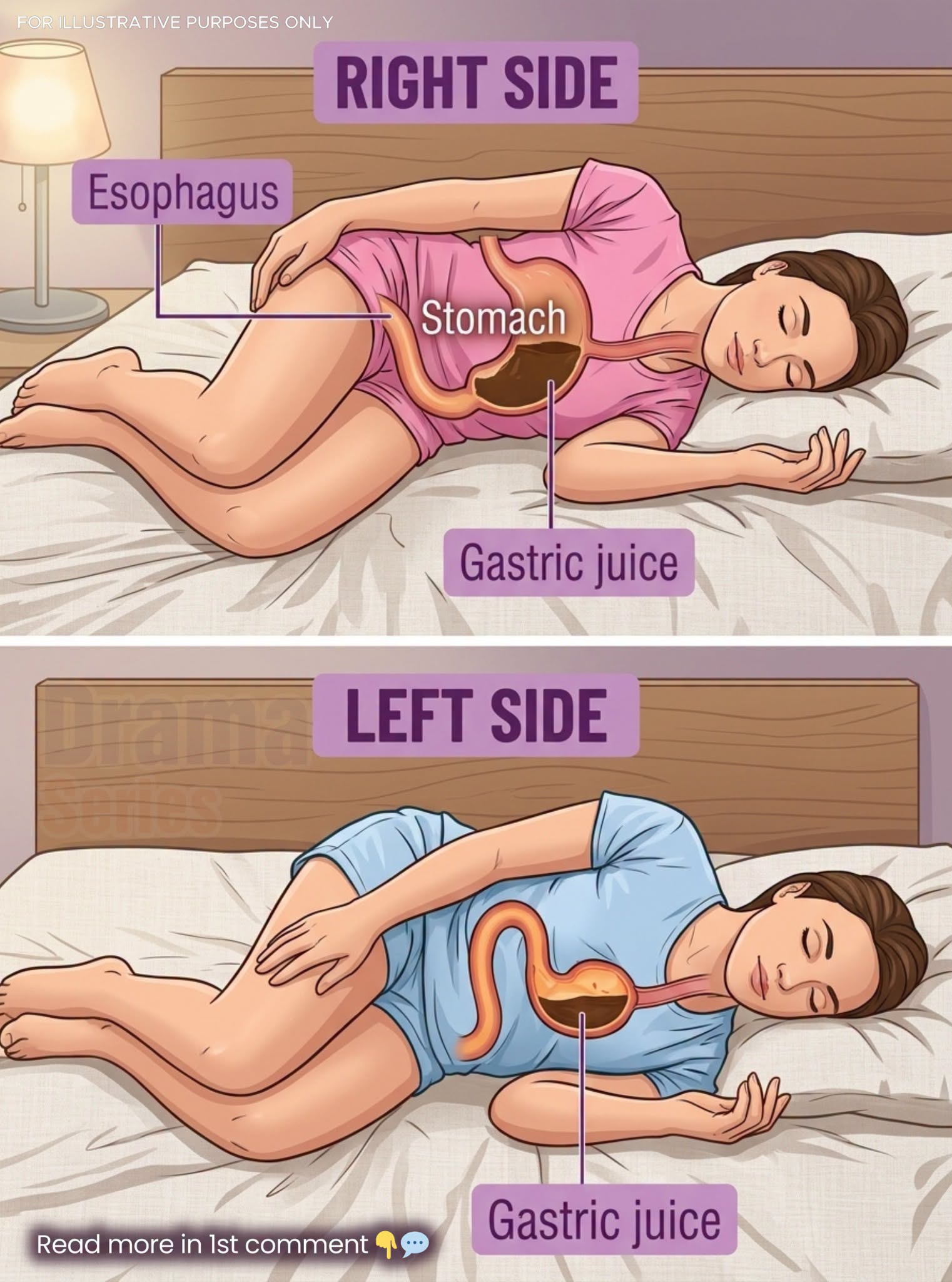 The Truth About Right-Side Sleeping and Snoring: Does It Help or Make Things Worse?